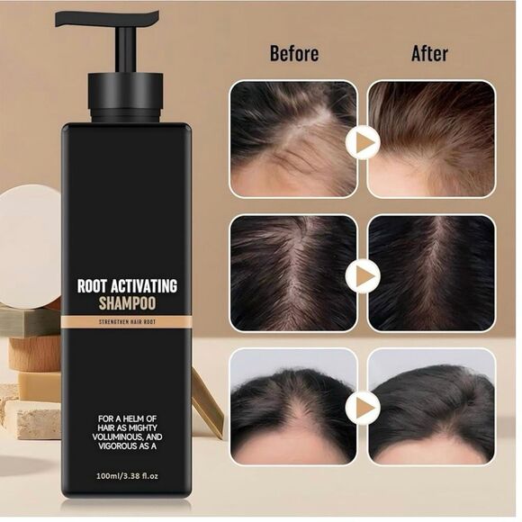 Root Activator Shampoo– Anti Hair Loss Treatment With Natural Regrowth Formula - Picture 4 of 6